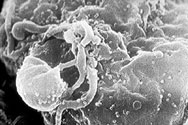 HIV micrografia
